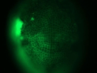 A Parhyale embryo expressing a membrane-localized GFP . . .