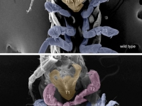 Ventral view SEM comparing a wild-type Parhyale hatchling (top) with a hatchling that had been injected with siRNAs targeting the Parhyale ortholog of the Hox gene . . .